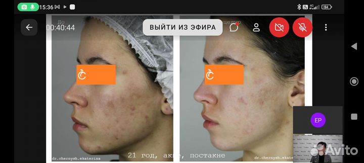 Пилинг WOWэффект