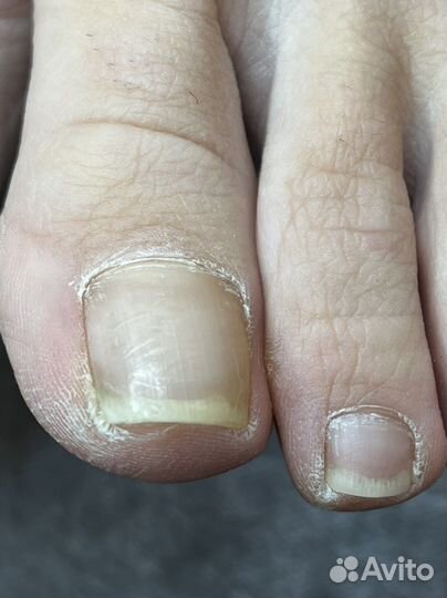 Педикюр, подология