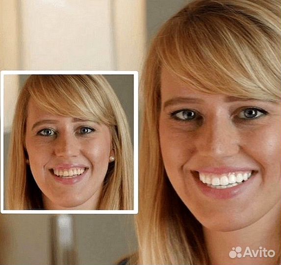 Домашнее отбеливание зубов