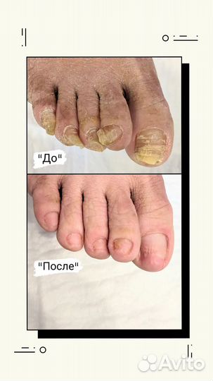 Услуги подолога