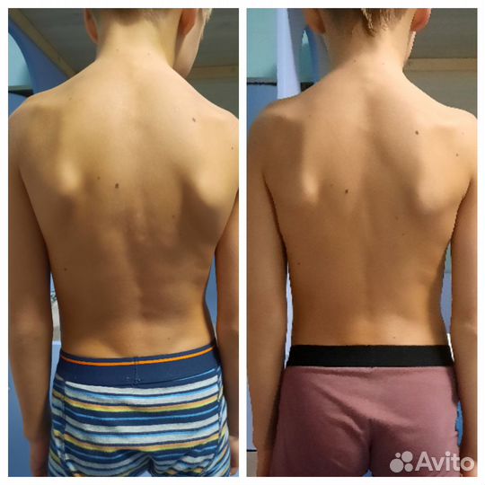 Массаж. Кинезиолог. Кинезиомассаж. Тейпирование