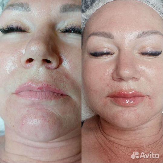 Косметология в Кабардинке