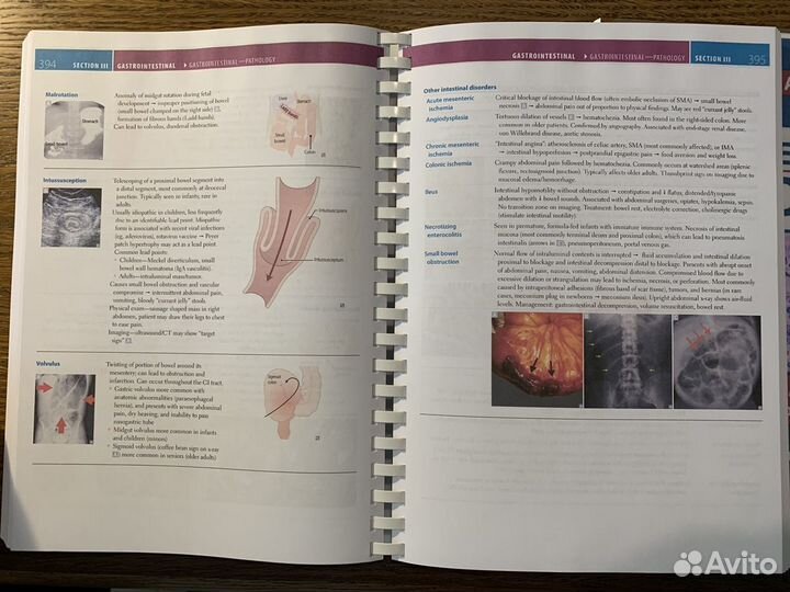 Usmle step 1. 2022. Две книги