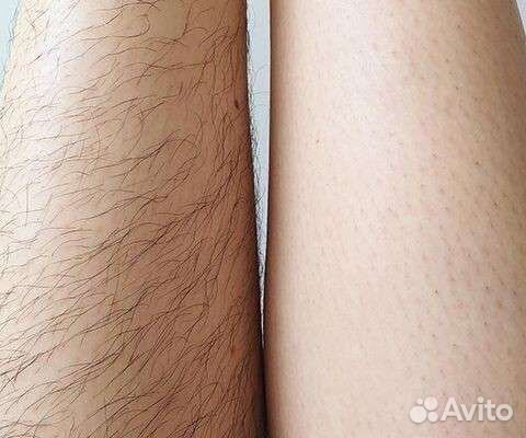 Шугаринг и прокол ушей