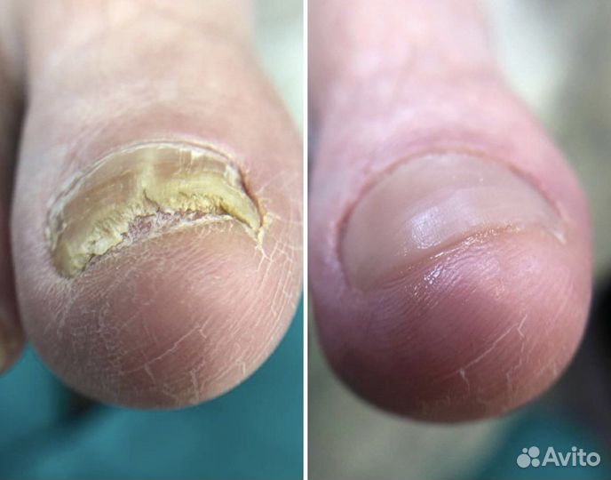 Услуги подолога