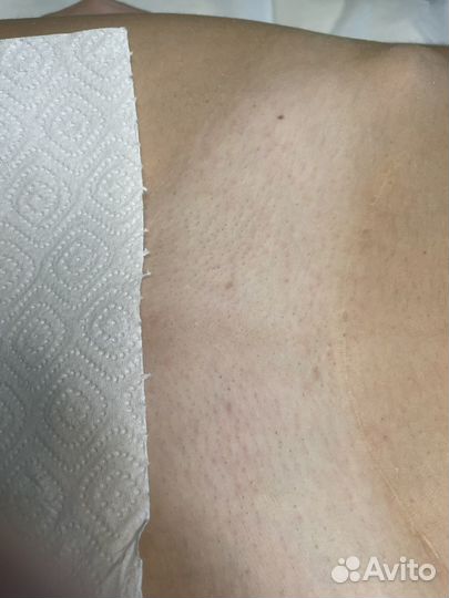 Модель на депиляцию