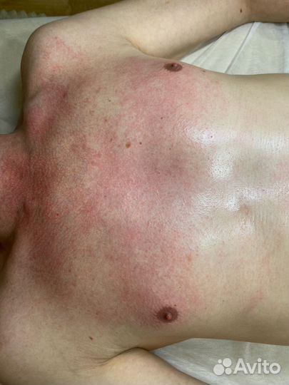 Мужская депиляция, по предоплате