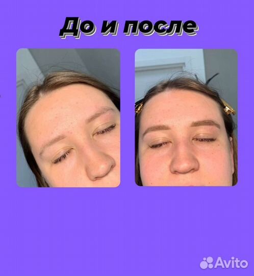 Брови, ресницы