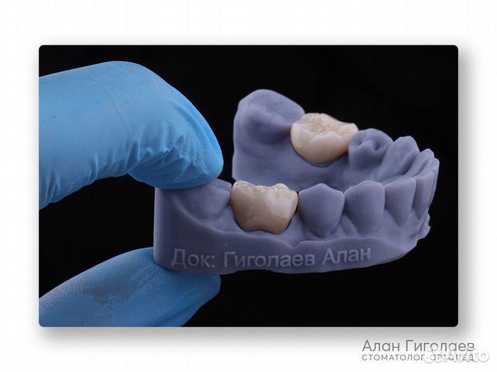 Услуги врача стоматолога ортопеда