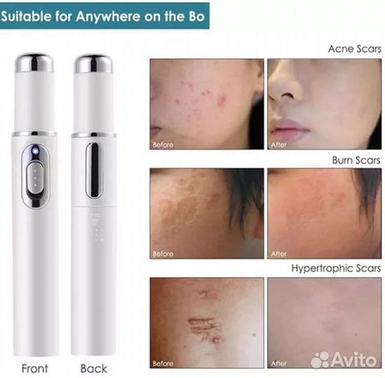 Косметологическая ручка