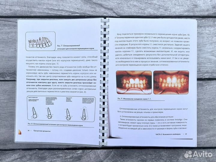 Прозрачная ортодонтия