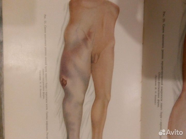 Опыт советской медицины в ВОВ 41 45г