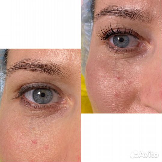 Ламинирование и ботокс ресниц