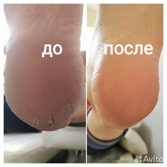 Подолог, педикюр, маникюр