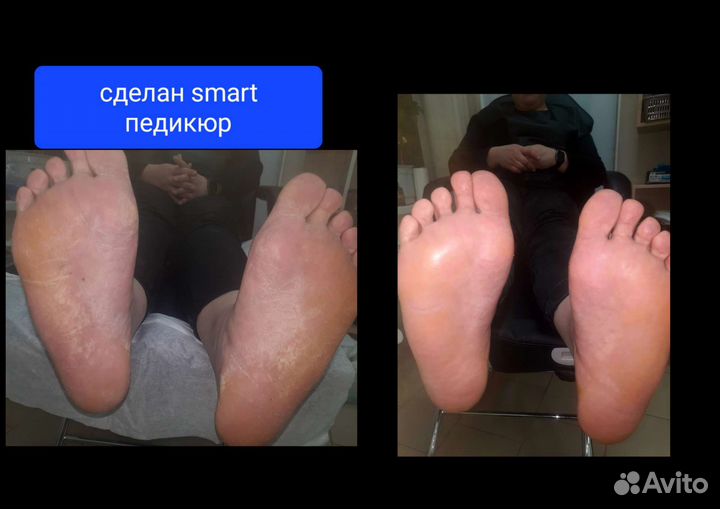 Подолог С мед. образованием, выезд на дом, педикюр