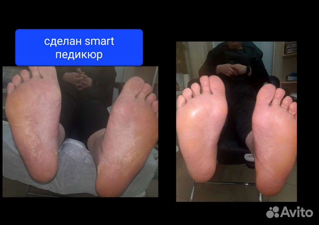 Подолог С мед. образованием, выезд на дом, педикюр