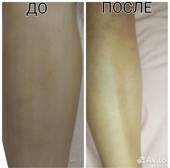 Восковая депиляция