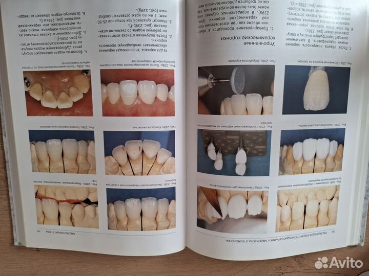 Современная Эстетическая Стоматология Б.Криспин