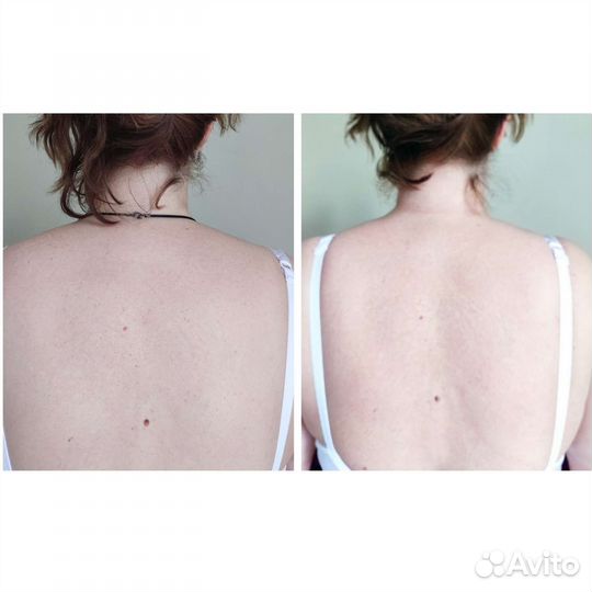 Массаж лица через тело