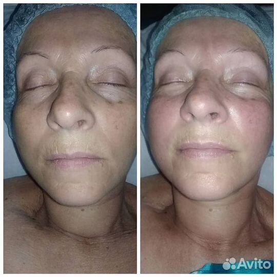 Массаж для женщин