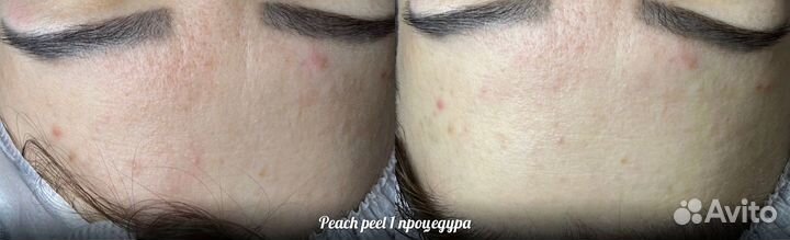 Услуги косметолога
