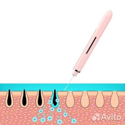 Уз скребок для лица Xiaomi InFace -Гарантия