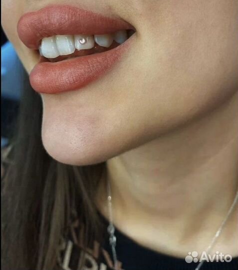 Установка скайсов