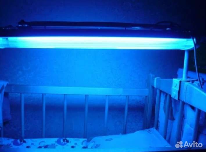 Лампа уфо от псориаза