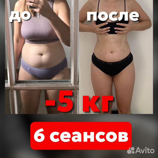 Антицелюллитный массаж LPG Похудение