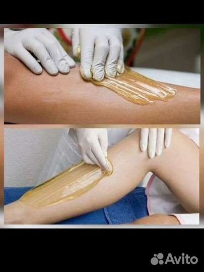 Шугаринг: руки выше локтя