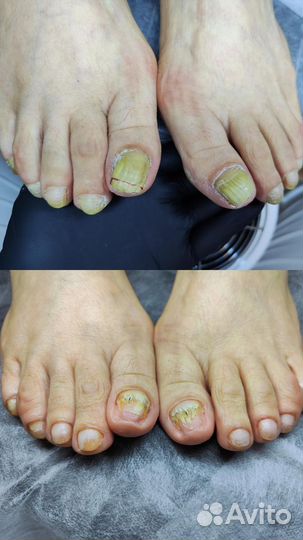 Подолог с выездом на дом