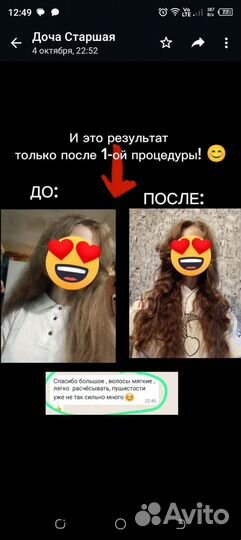 Экранизация волос