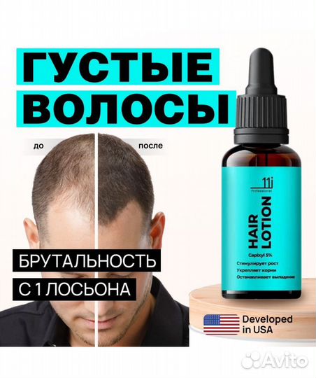 Лосьон для роста волос