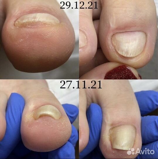 Подолог Балашиха