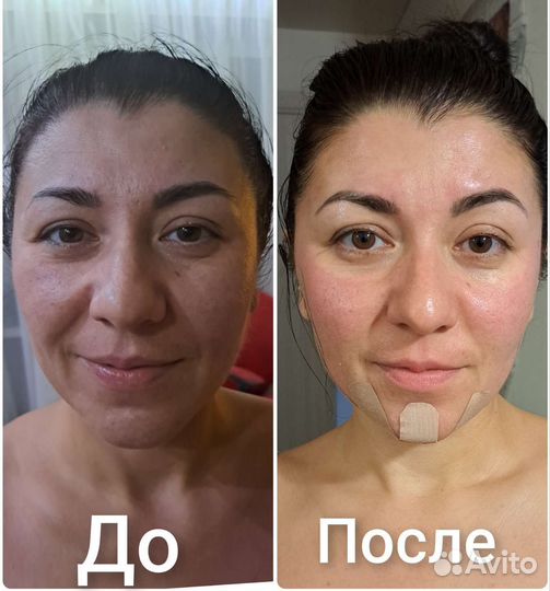 Массаж по лицу