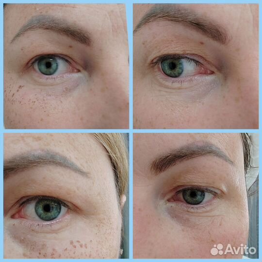 Холодная плазма