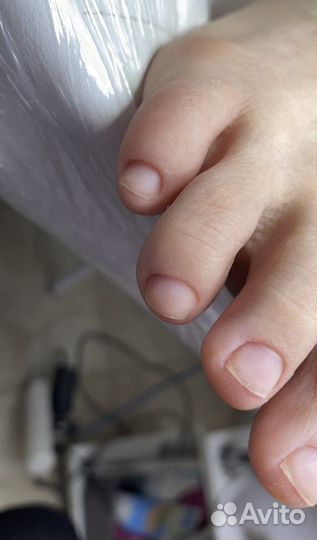 Набор клиентской базы на педикюр