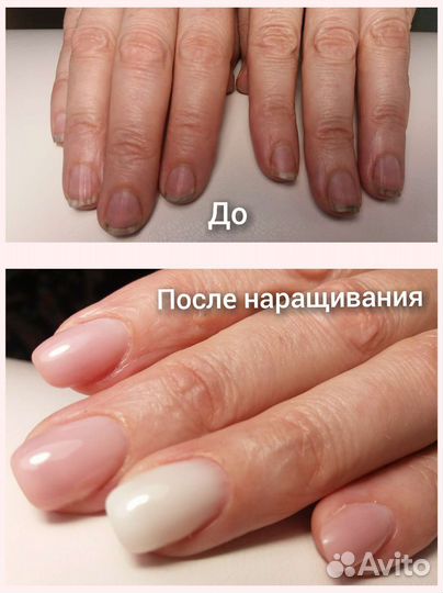 Маникюр, наращивание на дому