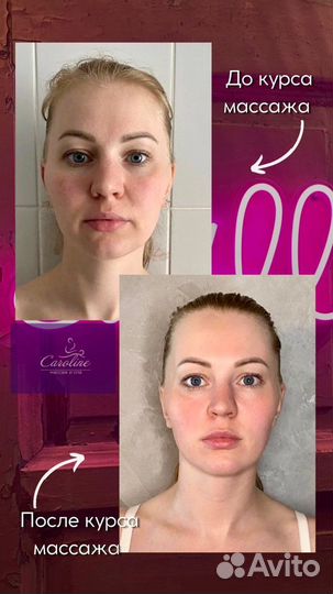 Спа-процедуры