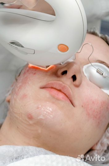 Аппарат м-22