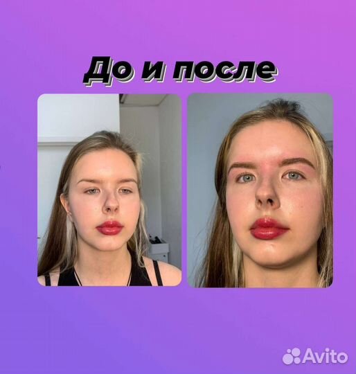 Брови, ресницы