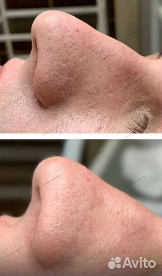 Услуги косметолога