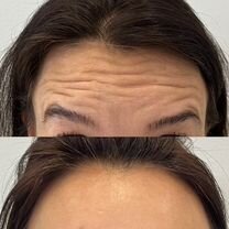 Косметолог, ботокс, биоревитализация, чистка, Санкт-Петербург