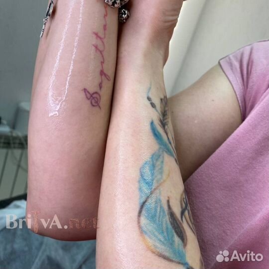 Депиляция