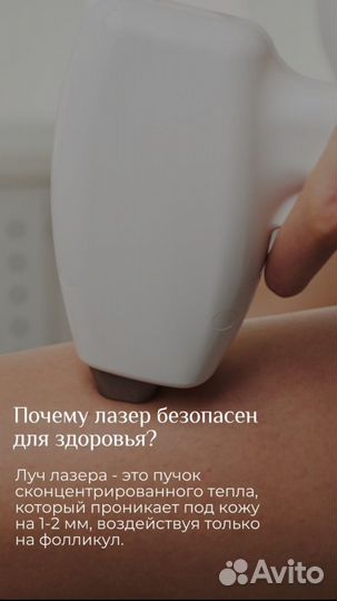 Лазерная эпиляция