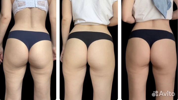 Антицеллюлитный массаж