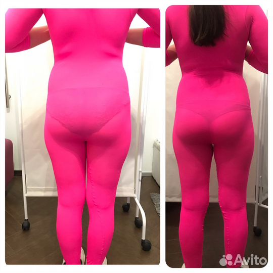 Антицеллюлитный массаж