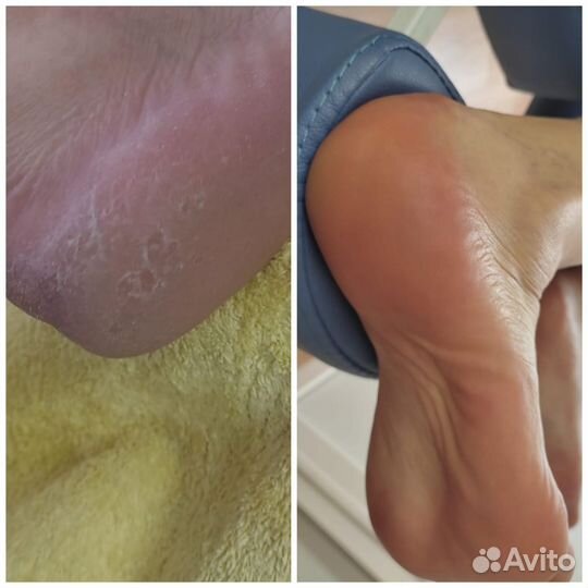 Маникюр, педикюр, покрытия