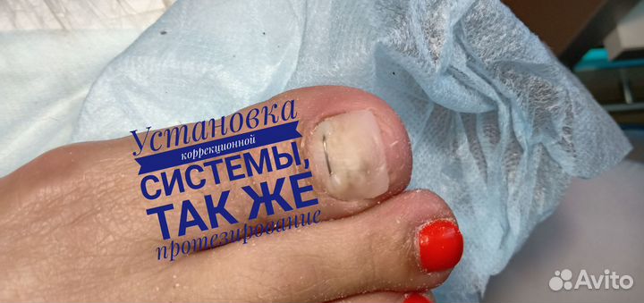 Подолог, педикюр