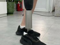 Современные протезы ног бесплатно